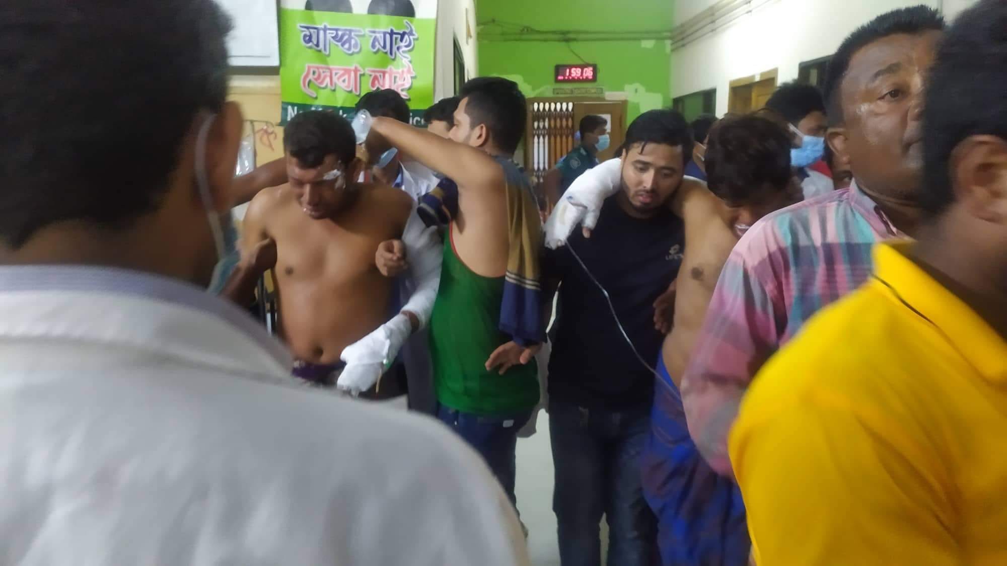 সীতাকুণ্ডে অগ্নিকাণ্ড: রোগীতে পরিপূর্ণ চমেকের আইসিইউ ইউনিট