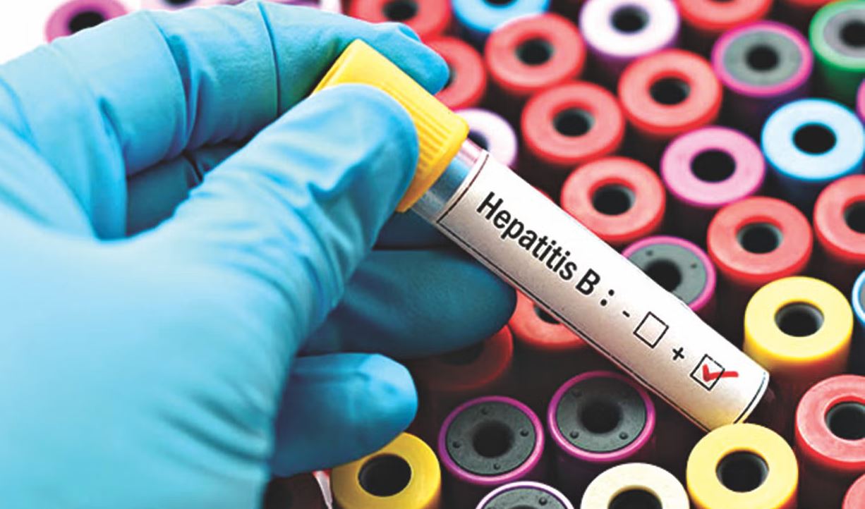 হেপাটাইটিস বি কীভাবে ছড়ায়, লক্ষণ ও চিকিৎসা কী