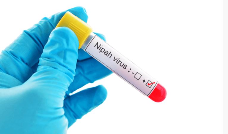 নিপাহ ভাইরাসের লক্ষণ কী, খেজুর গুড় বা রস ফুটিয়ে খেলেও কি এটি ছড়ায়