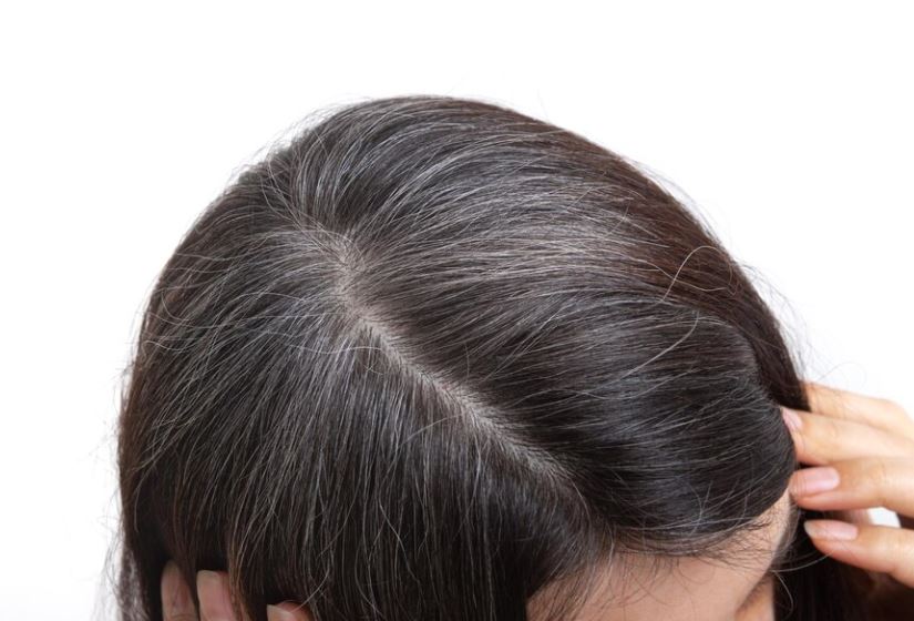 একটা পাকা চুল টেনে তুললে কি অনেকগুলো গজায়?