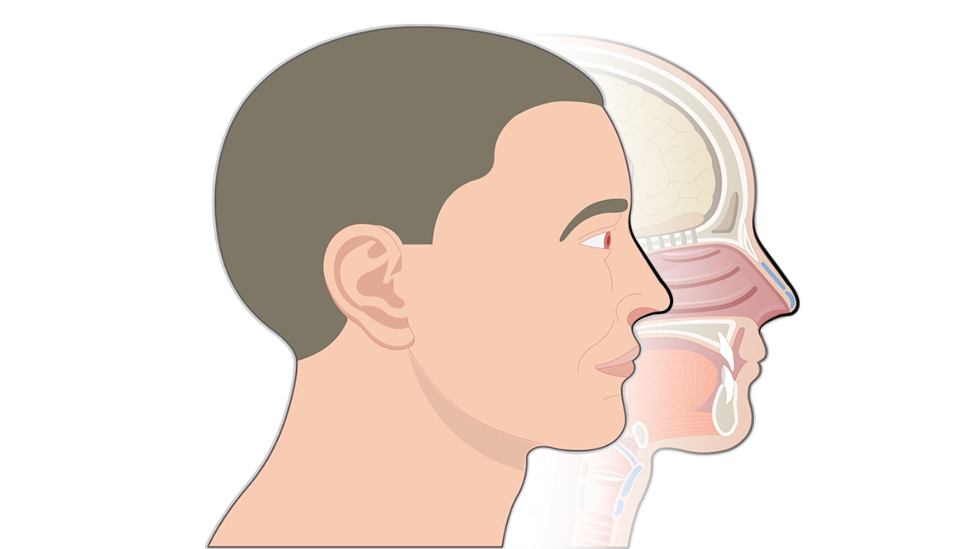 নাকের পলিপ কী, কেন হয়