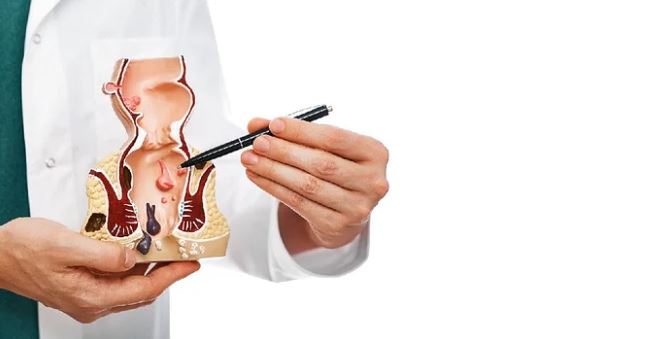 ফিস্টুলা কেন হয়, চিকিৎসা কী