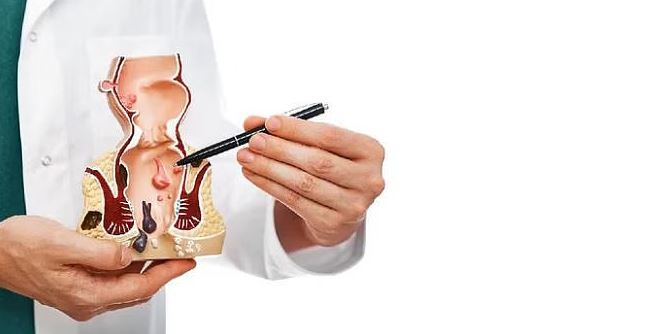 পাইলস কেন হয়, লক্ষণ ও চিকিৎসা কী