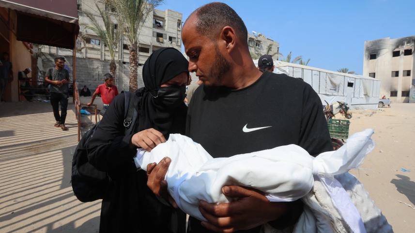 Gaza Malnourished baby