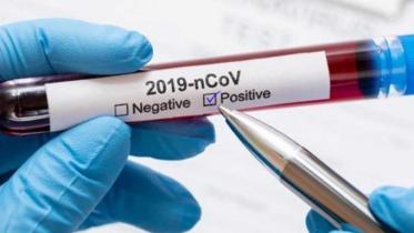 test_coronavirus-positive_0_0.jpg